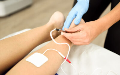 Dry Needling with Electrical Stimulation